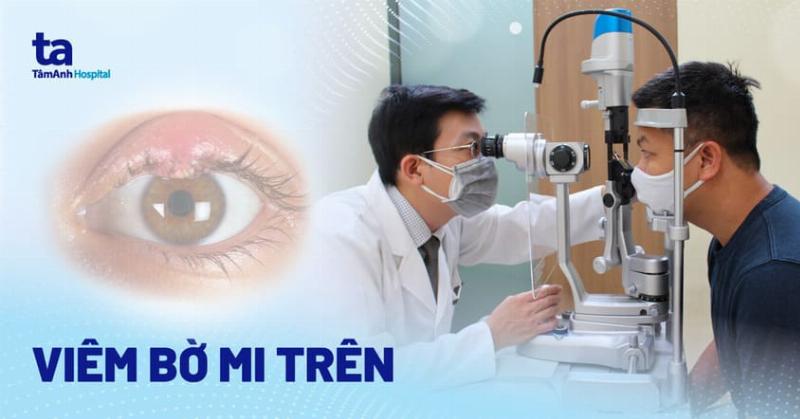 Hình ảnh minh họa các nguyên nhân phổ biến gây mụt lẹo mắt, bao gồm vi khuẩn và tuyến dầu bị tắc nghẽn